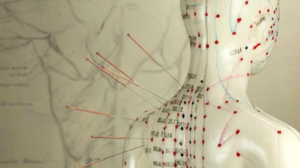 ACUPUNCTURE_VISCERAL